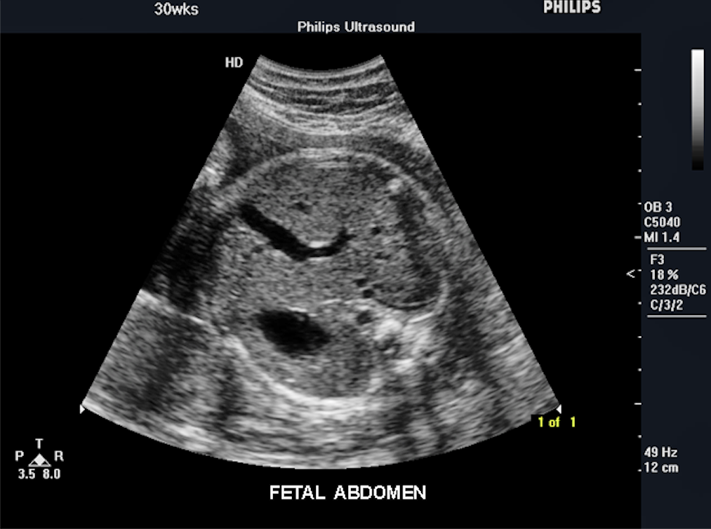 Envisor Imaged Imaging Prenatal Ob 